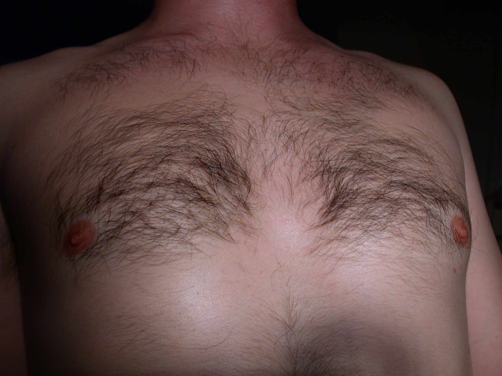 к чему снятся волосы на груди у мужчин фото 116