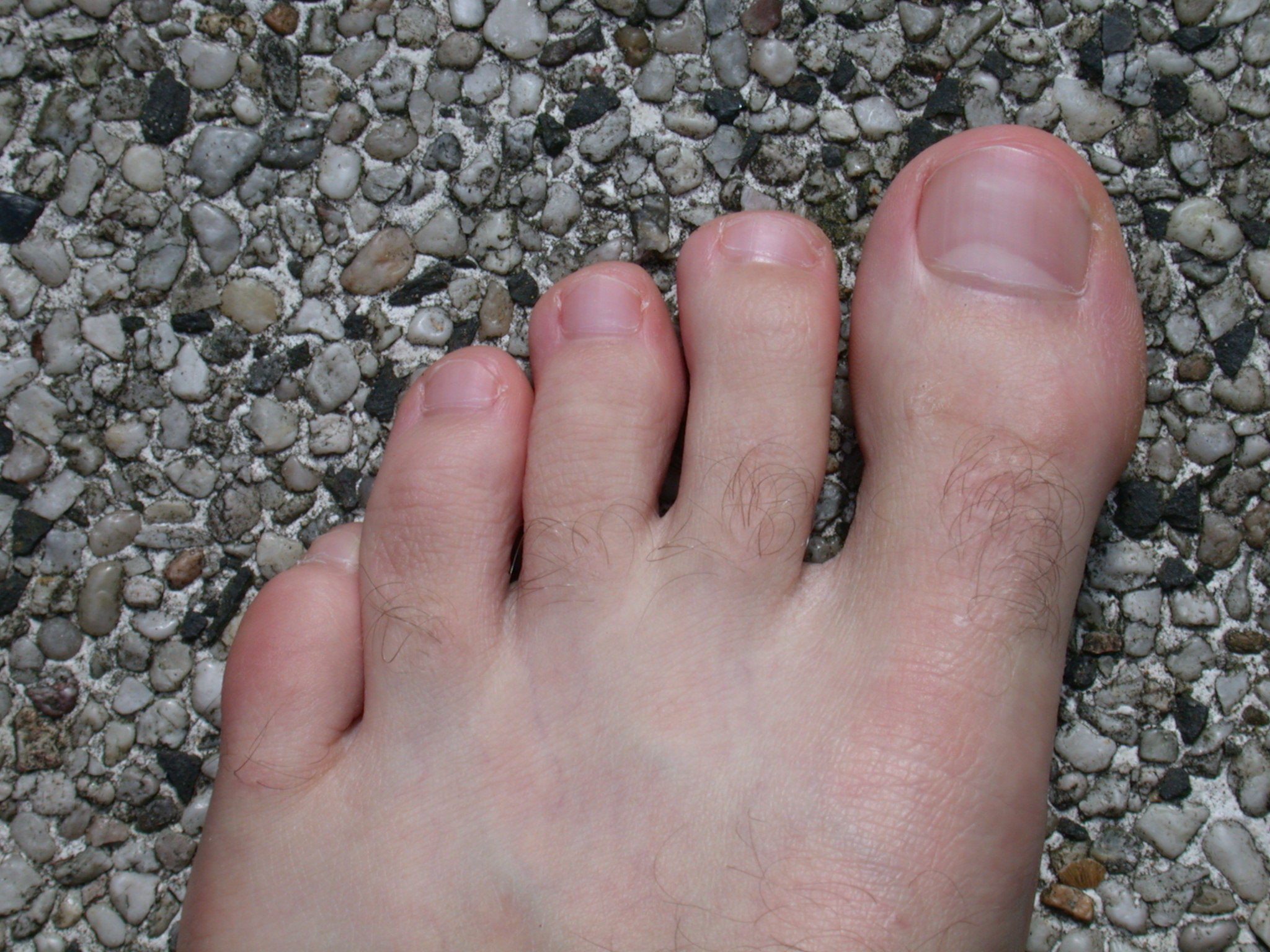 image-after-photos-foot-skin-texture-hair-top-flesh-vein-toe-toes