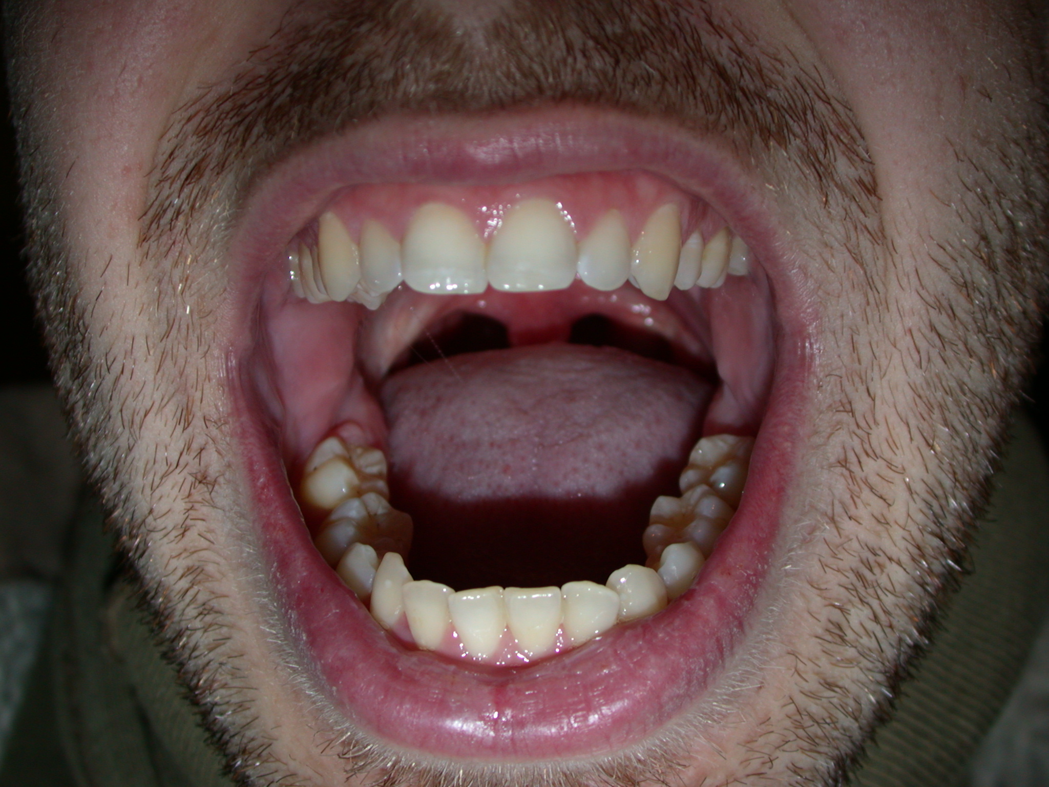 nature characters humanparts scream mouth teeth tongue beard fear shock male lips uvula tooth