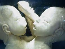 baby nature characters humanoids twin twins lab hair hairy babys face faces science siamesetwin siamesetwins siamese wrinkled