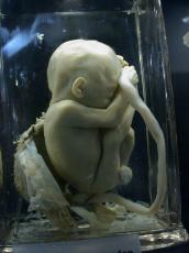 nature characters humanoids toddler baby embryo unborn human side laboratory lab glass umbilicalcord cord umbilical