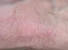 skin texture pink macro flesh foot top hair hairy hairs vein veins