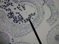 cells needle pink membrane
